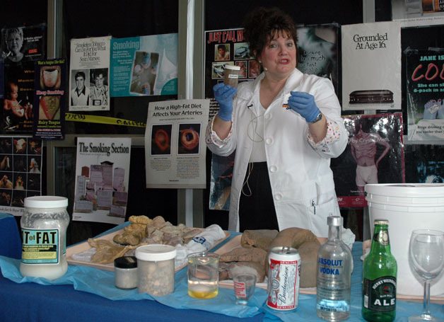 Arlington-based registered nurse and â€śOrgan Ladyâ€ť Kathy Ketchum holds up a container full of gallstones during â€śInsideOut: The Original Organ Showâ€ť at the Providence Regional Medical Center in Everett on Feb. 25.